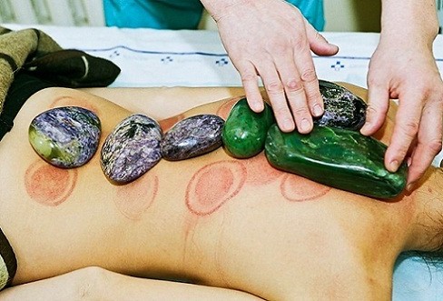 Камни в Китайской медицине